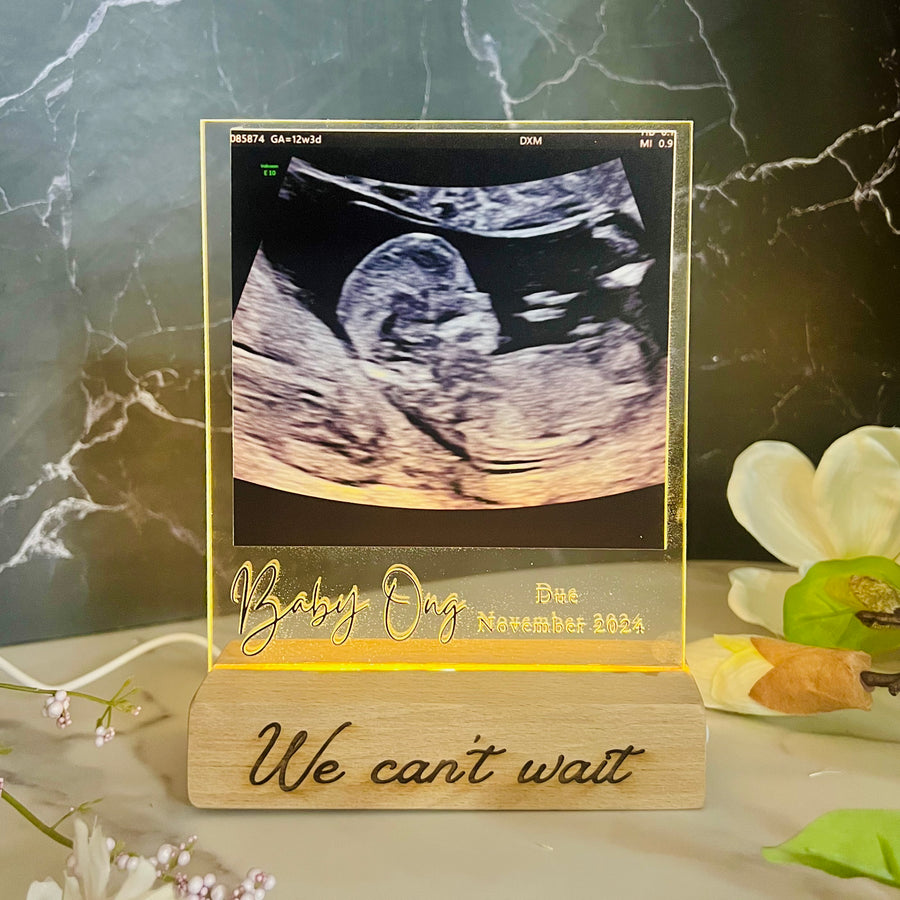 Custom 3D Ultrasound Photo & Name LED Sign, Personalised Acrylic Hello Baby Scan Photo Plaque, Nursery's Night Light, UV Printed Table Lamp Room Decor, 1st Birthday Gift